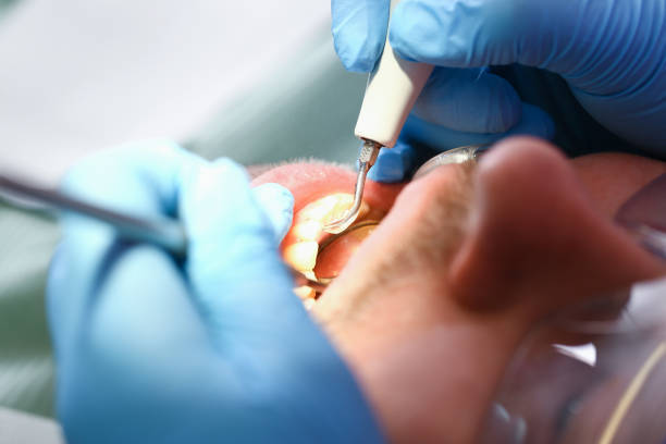 Best Emergency Dental Care for Trauma or Injury in Griffin, GA