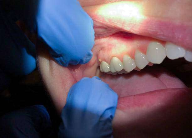 Best Emergency Dental Care for Trauma or Injury in Griffin, GA