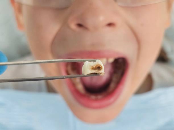 Best Emergency Dental Surgery in Griffin, GA